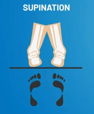 Foot-Supination